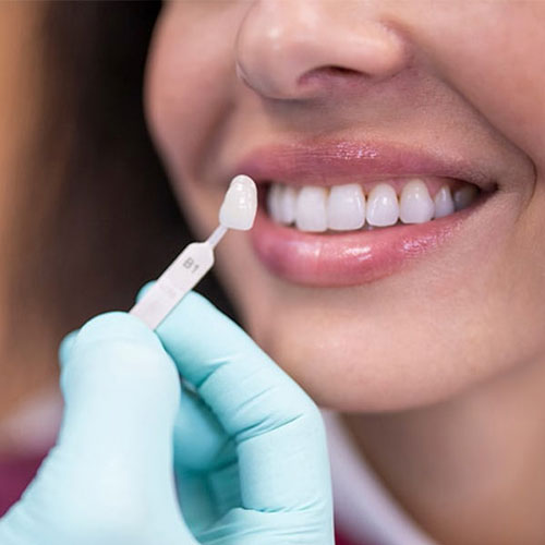 انواع کامپوزیت دندان