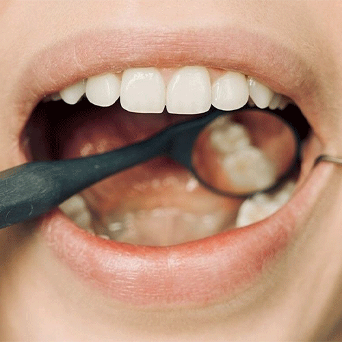 ترمیم دندان