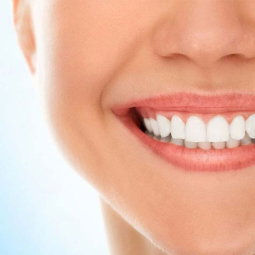 فواید بلیچینگ دندان