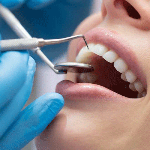 روش های معاینه برای ترمیم دندان پوسیده شده