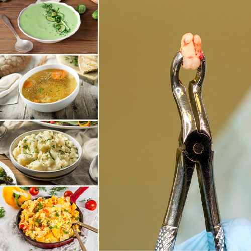 بعد از کشیدن دندان چی بخوریم؟